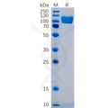 Human ICAM-1 Protein, mFc Tag – Figure 1 of 1