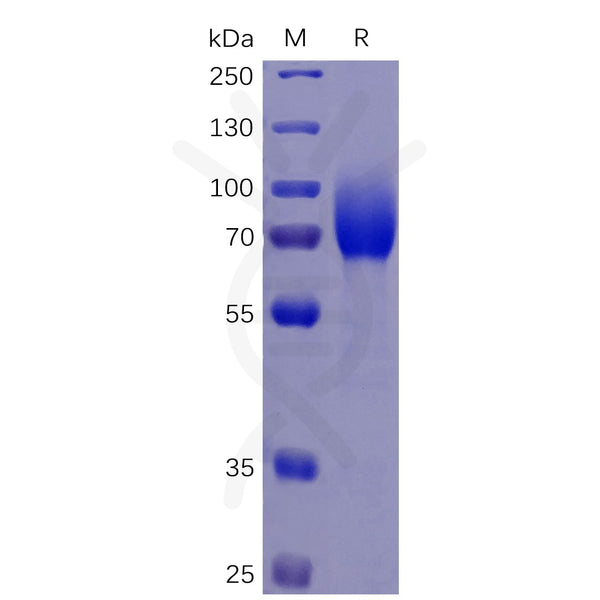 Human CSF1R Protein, His Tag – Figure 1 of 1