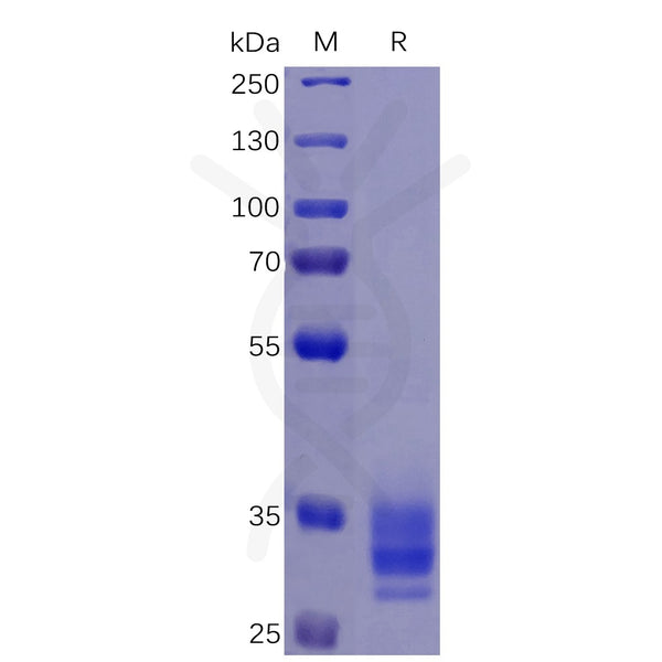 Human EPCAM Protein, His Tag – Figure 1 of 1