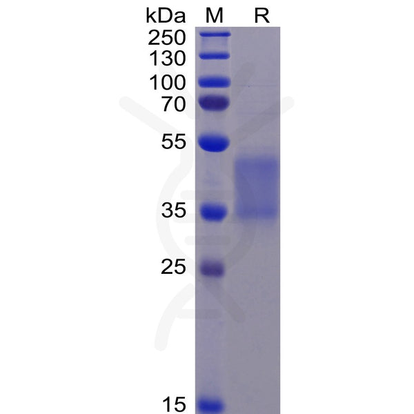 Human FCGR3A Protein (F176V), His Tag – Figure 1 of 1