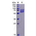Human AXL Protein, His Tag – Figure 1 of 1