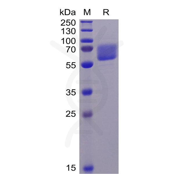 Human AXL Protein, His Tag – Figure 1 of 1