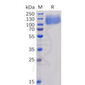 Human CEACAM5 Protein, His Tag – Figure 1 of 1