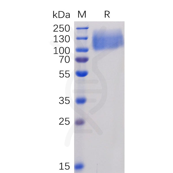Human CEACAM5 Protein, His Tag – Figure 1 of 1