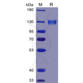 Human ACE2 Protein, mFc Tag – Figure 1 of 1