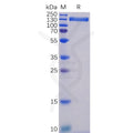 Human ACE2 Protein, hFc Tag – Figure 1 of 1