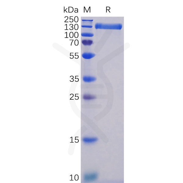 Human ACE2 Protein, hFc Tag – Figure 1 of 1