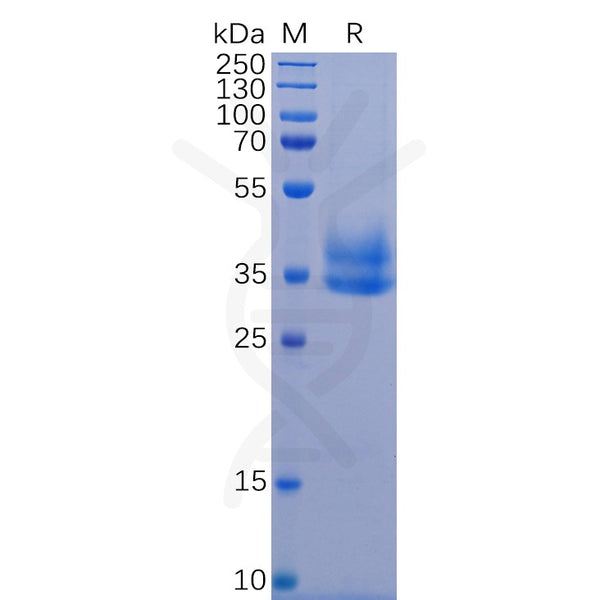 Human IL2RB Protein, His Tag – Figure 1 of 1