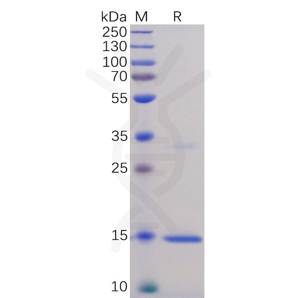 Human TNFa Protein, His Tag – Figure 1 of 1