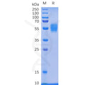 Human NKG2D Protein, mFc Tag – Figure 1 of 1