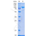 Human CD114 Protein, His Tag – Figure 1 of 1
