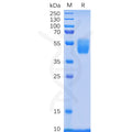 Human PSCA Protein, hFc Tag – Figure 1 of 1