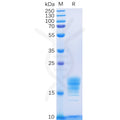 Human IL5 Protein, His Tag – Figure 1 of 1