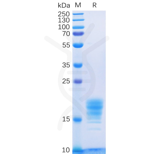 Human IL5 Protein, His Tag – Figure 1 of 1