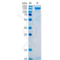 Human SELP Protein, hFc Tag – Figure 1 of 1