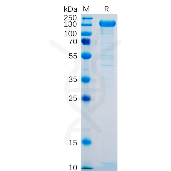Human SELP Protein, hFc Tag – Figure 1 of 1