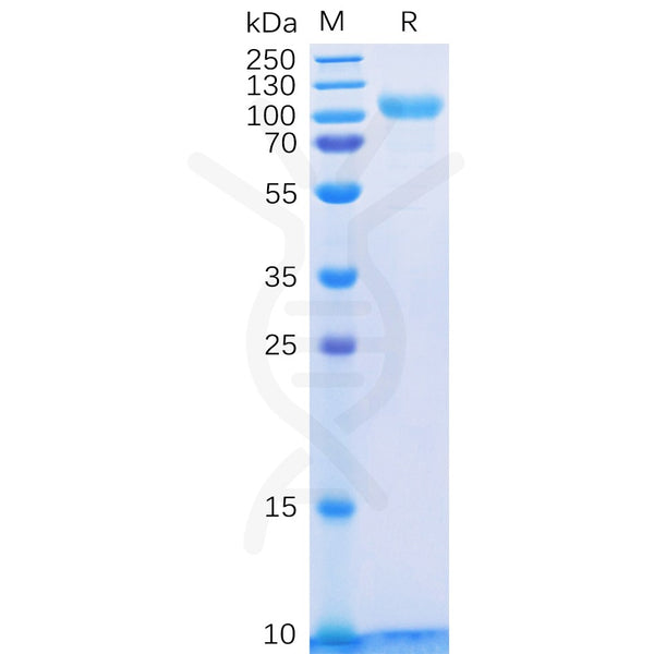 Human HER3 Protein, His Tag – Figure 1 of 1
