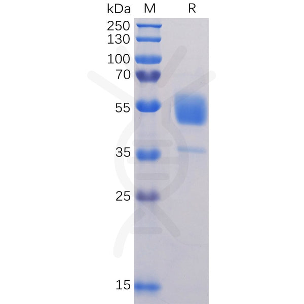 Human CD37 Protein, hFc Tag – Figure 1 of 1