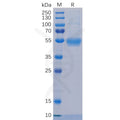 Human IL5RA Protein, His Tag – Figure 1 of 1
