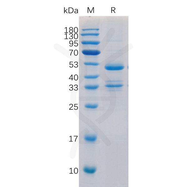 Human TACI Protein, hFc Tag – Figure 1 of 1