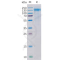 Human Her2 Protein, His Tag – Figure 1 of 1