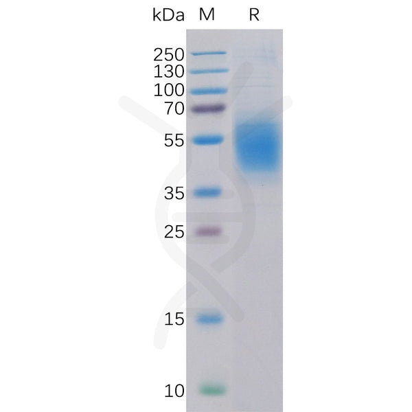 Human CLEC12A Protein, His Tag – Figure 1 of 1