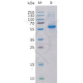 Human ROR2 Protein, His Tag – Figure 1 of 1