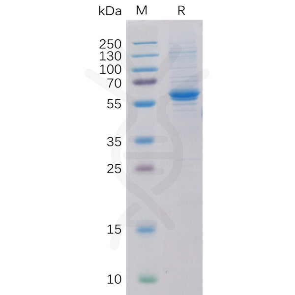 Human ROR2 Protein, His Tag – Figure 1 of 1