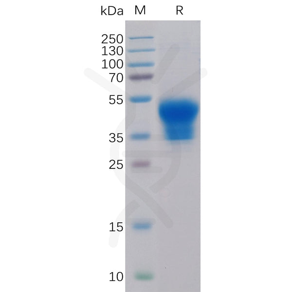 Human IL2RA Protein, His Tag – Figure 1 of 1
