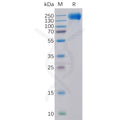 Human EGFR Protein, His Tag – Figure 1 of 1
