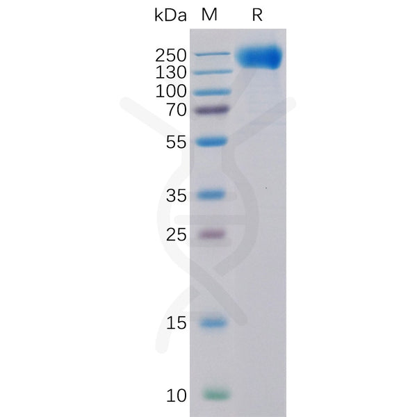 Human EGFR Protein, His Tag – Figure 1 of 1