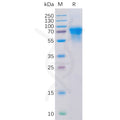 Human CD46 Protein, His Tag – Figure 1 of 1