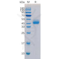 Human TGFBR1 Protein, N-hFc Tag – Figure 1 of 1