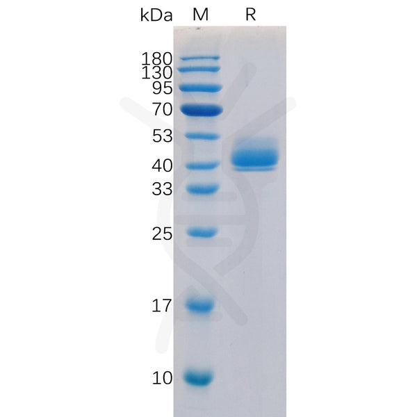 Human TGFBR1 Protein, N-hFc Tag – Figure 1 of 1
