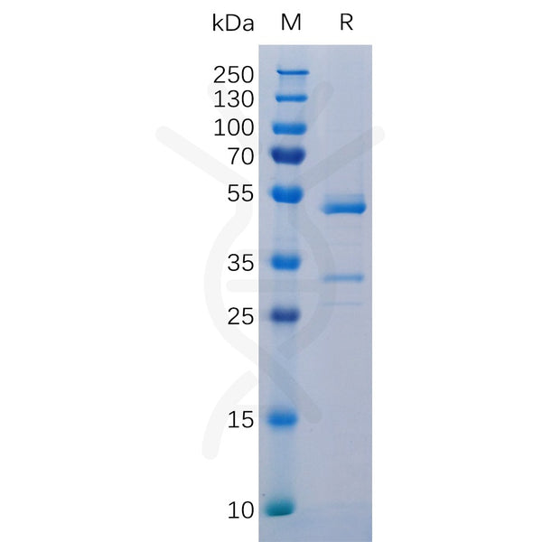 Human TNFSF12 Protein, hFc Tag – Figure 1 of 1