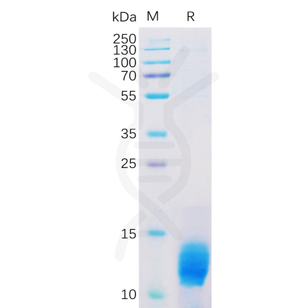 Human MUC1 Protein, HisTag – Figure 1 of 1