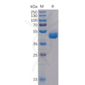 Human TIGIT Protein, hFc Tag – Figure 1 of 1