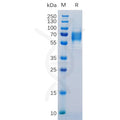 Human IL6R Protein, His Tag – Figure 1 of 1