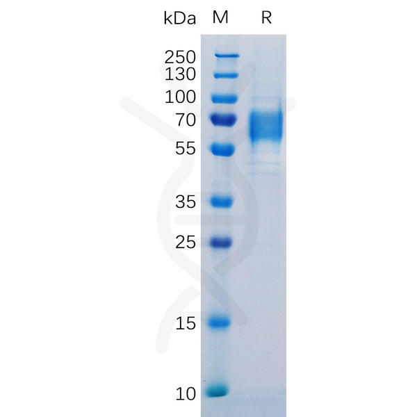 Human IL6R Protein, His Tag – Figure 1 of 1