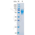 Human 5T4 Protein, His Tag – Figure 1 of 1