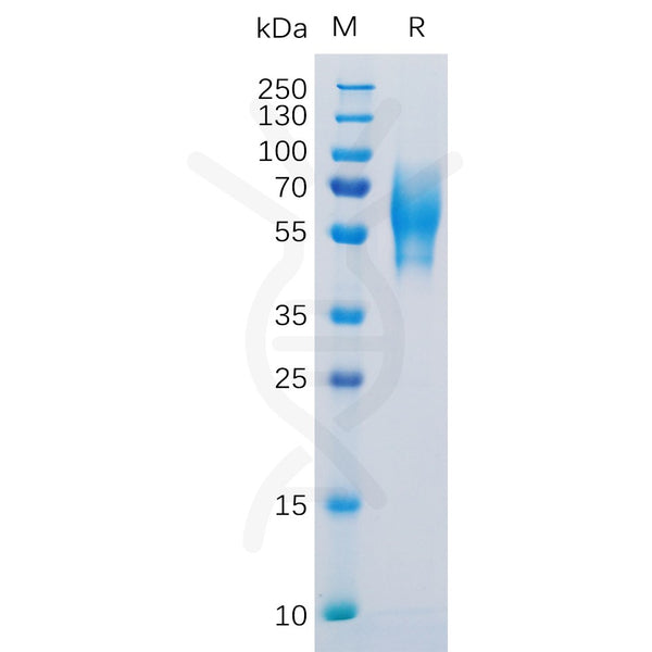 Human 5T4 Protein, His Tag – Figure 1 of 1