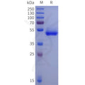 Human ACPP Protein, His Tag – Figure 1 of 1