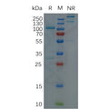 Human ADAM9 Protein, hFc Tag – Figure 1 of 1
