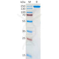 Human ALK Protein, hFc Tag – Figure 1 of 1