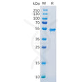 Human CA9 Protein, His Tag – Figure 1 of 1