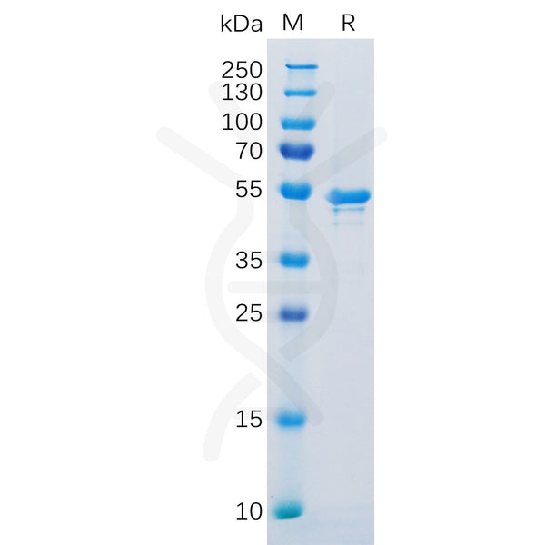 Human CA9 Protein, His Tag – Figure 1 of 1