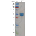 Human CB2 (1-33) Protein, hFc Tag – Figure 1 of 1