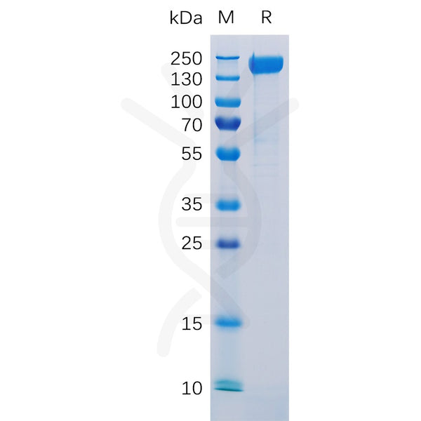 Human CD171 Protein, His Tag – Figure 1 of 1