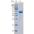 Human CD40 Ligand Protein, hFc Tag – Figure 1 of 1