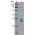 Human CLEC2D Protein, N-His Tag – Figure 1 of 1